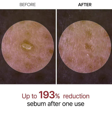 Rice Peeling Glow Ampoule